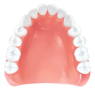 レジン床義歯（保険適応）